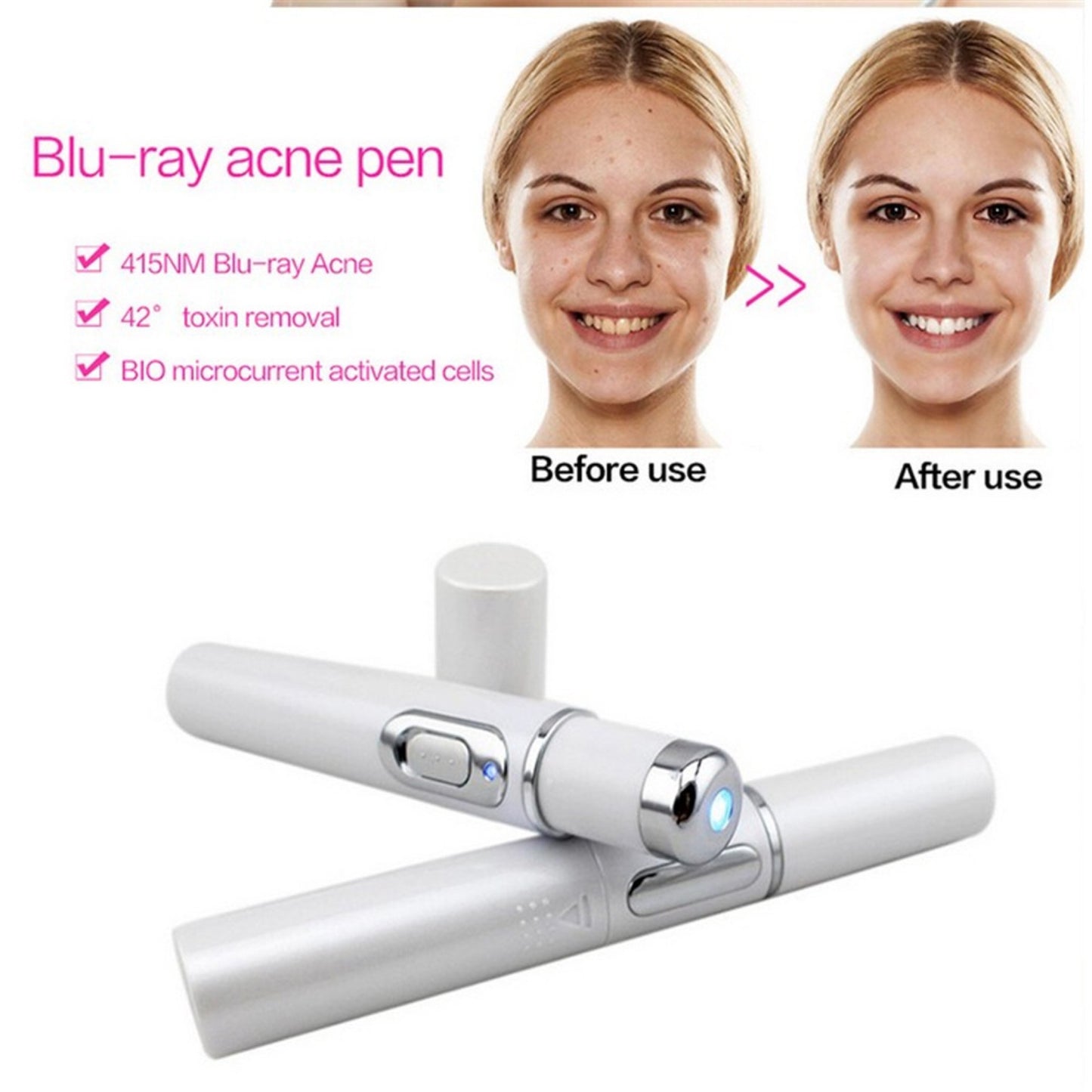 Blue Light Therapy Acne Laser Pen Skin Care