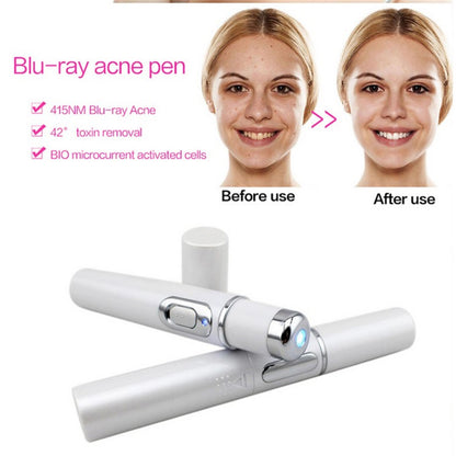Blue Light Therapy Acne Laser Pen Skin Care