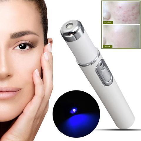 Blue Light Therapy Acne Laser Pen Skin Care