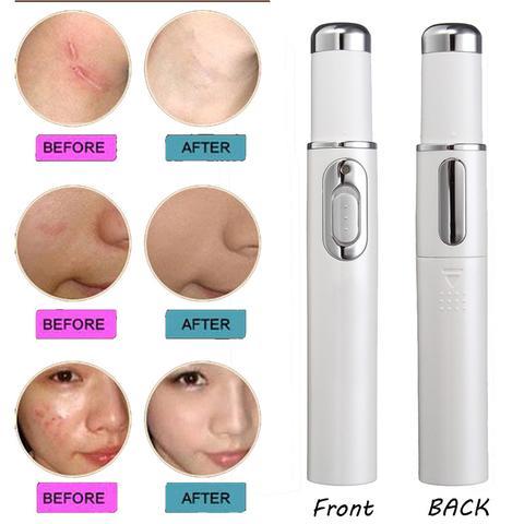 Blue Light Therapy Acne Laser Pen Skin Care